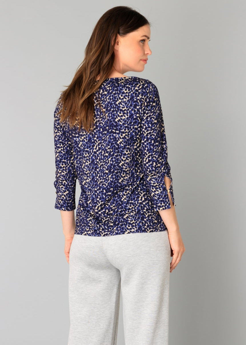 Yest - Bryn Top - SALE